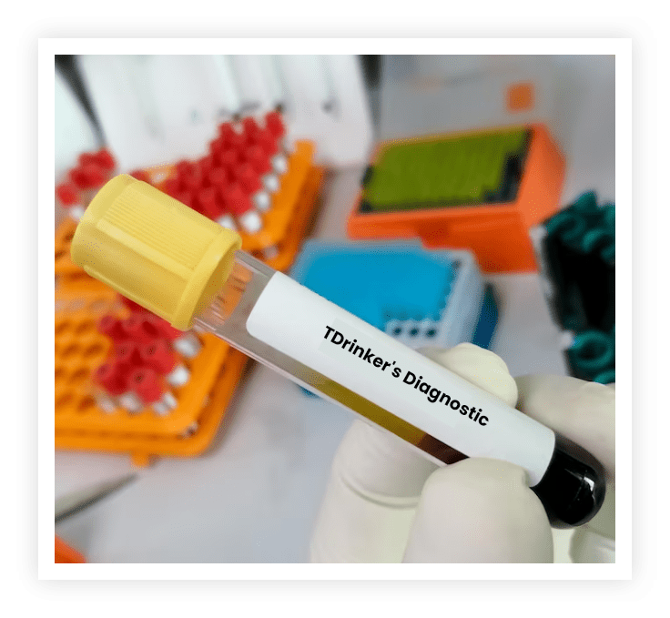 Alcohal Diagnosis Alcohal Diagnosis
